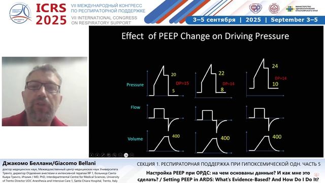 Настройка PEEP при ОРДС на чем основаны данные Джакомо Беллани