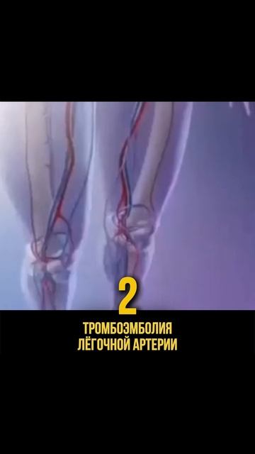 БЕРИТЕ В САМОЛЕТ ЧУЛКИ смотреть онлайн