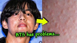 🚨Тэхён рассказывал о состоянии здоровья, но менеджер вмешался, новости о Шуге