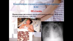 4. Сокологорский С.В.  Синдром Мендельсона в акушерстве