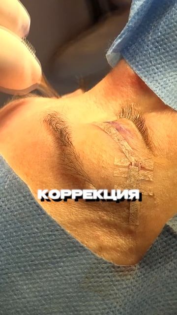 Почему девушки делают пластику?