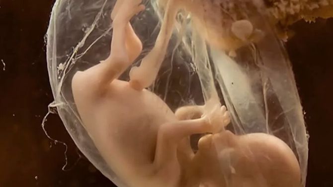 Околоплодные воды плода смотреть онлайн