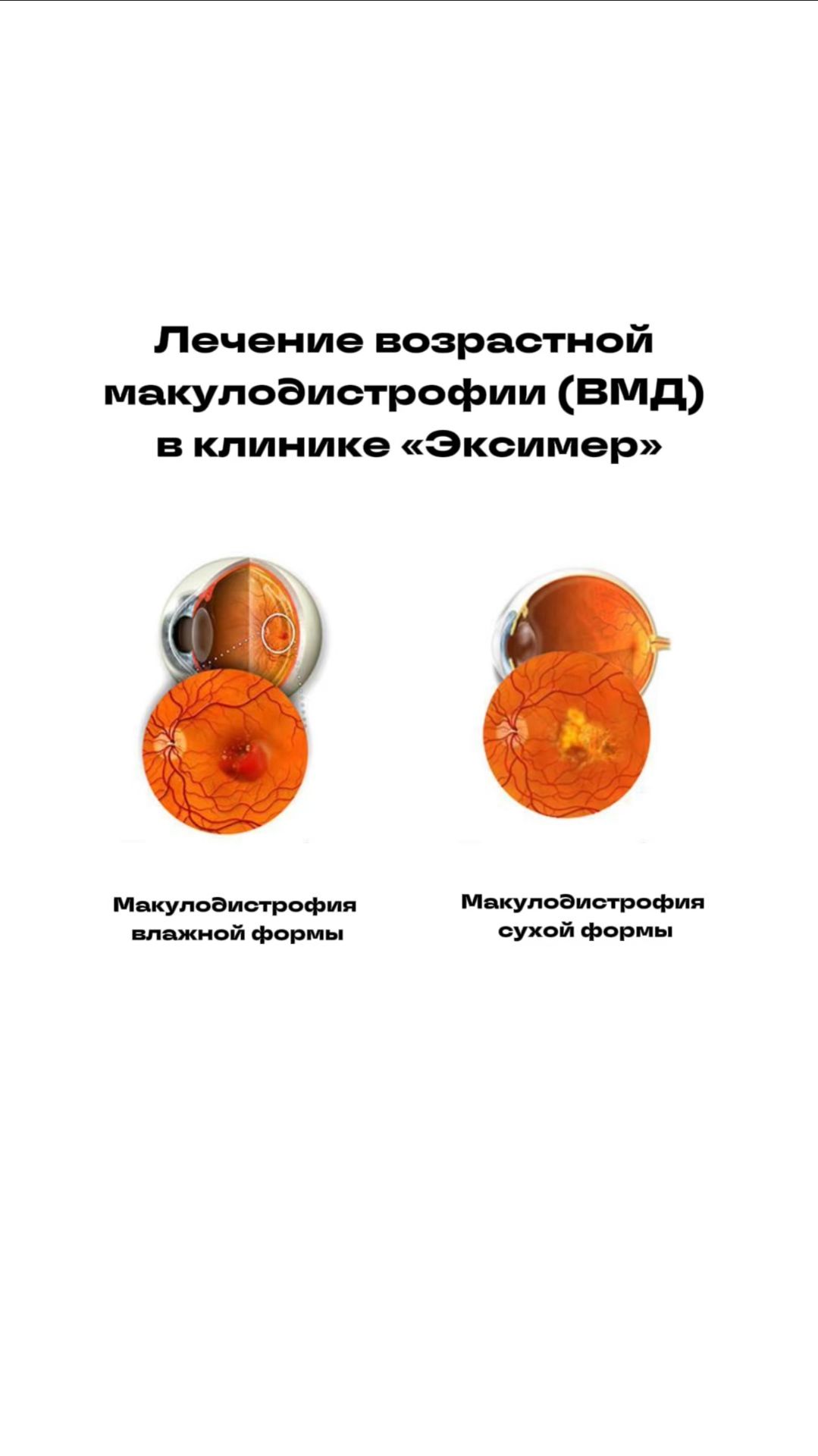 Берегите своё зрение сегодня — чтобы завтра видеть мир ясно 🌅 смотреть онлайн