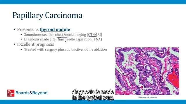 5.Thyroid Cancer смотреть онлайн