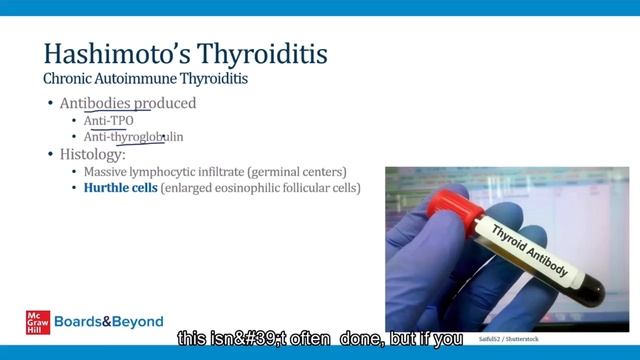 4.Hypothyroidism and Thyroiditis смотреть онлайн