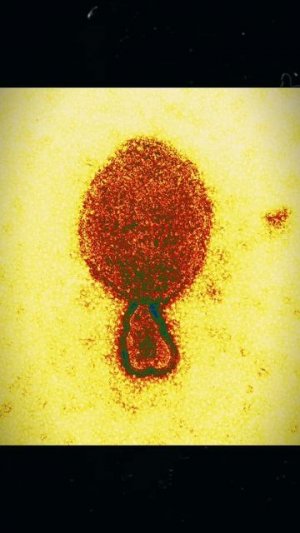 Эти красотки не такие милые,как кажутся #летучиимыши #жуткиефакты