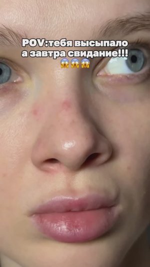 Спасаемся от черных точек