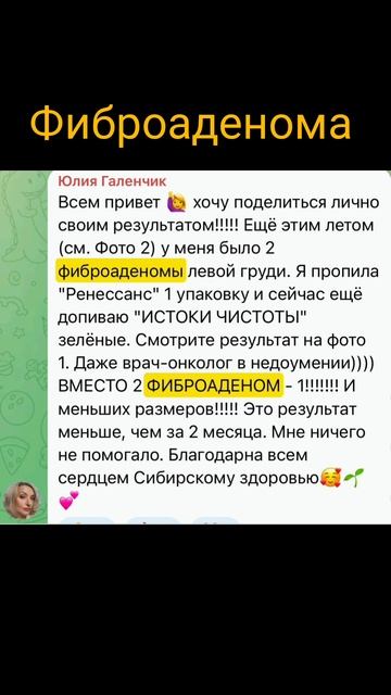 фиброаденома #shorts