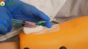 Техника введения растворов в вену через периферический катетер с использованием нескольких шприцев