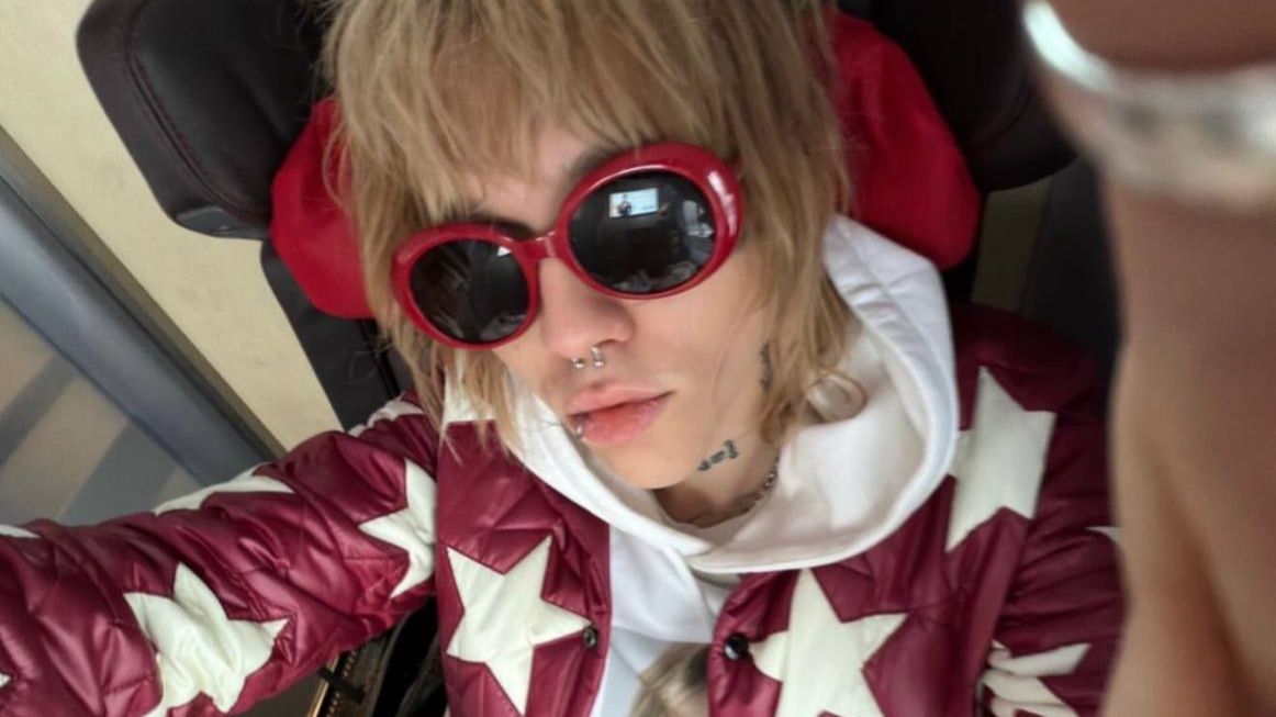 первая стадия