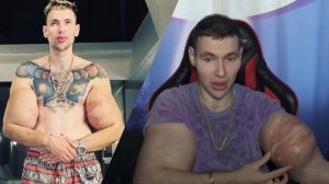 ТРЕШ-ФРИК БЛОГЕР Кирилл Терешин (Руки Базуки). Может потерять конечности из-за плохих анализов (