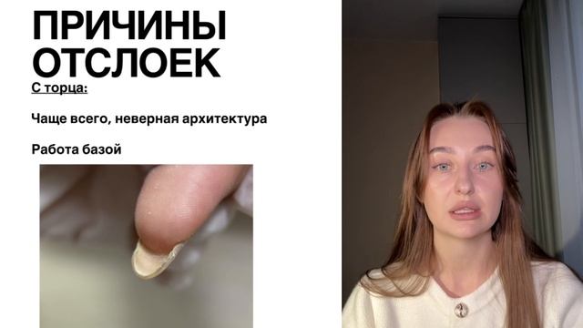 Без отслоек ЛМ смотреть онлайн