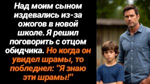 Жизненные Истории/Над моим сыном издевались в школе из-за ожогов, но когда я поговорил