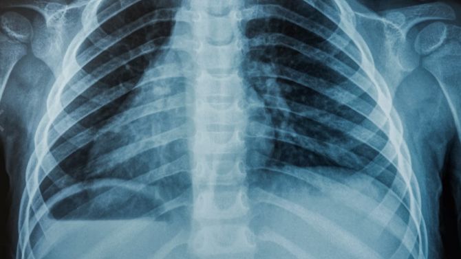 Можно ли делать рентген при беременности смотреть онлайн