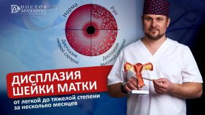 Дисплазия шейки матки: от легкой до тяжелой степени за несколько месяцев