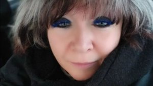 Велгия. Результаты после уколов Велгии за 4 месяца.