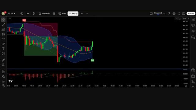 Bollinger Band + SuperTrend Trading Strategy That Actually Works - 360 смотреть онлайн