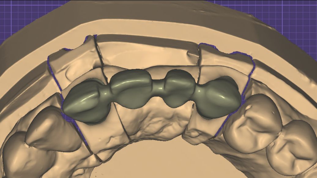 Моделирование каркаса под МК. смотреть онлайн