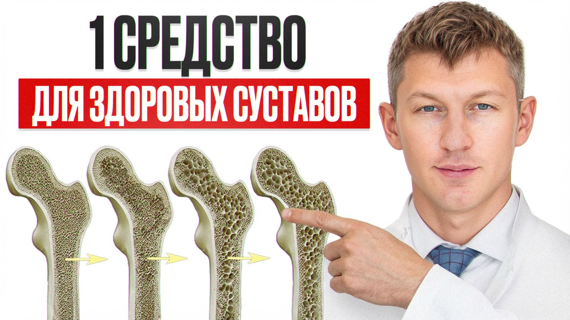 Врач назвал 1 продукт для пожилых, чтобы ходить БЕЗ БОЛИ смотреть онлайн