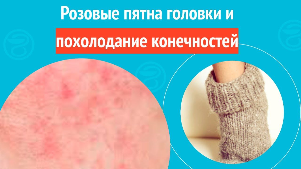 🦵 Розовые пятна головки и похолодание конечностей. Клинический случай №1562 смотреть онлайн