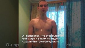 Ампутация или могила: «Руки-Базуки» почернели и гниют. Врач объяснил, какой выбор есть у Терёшина