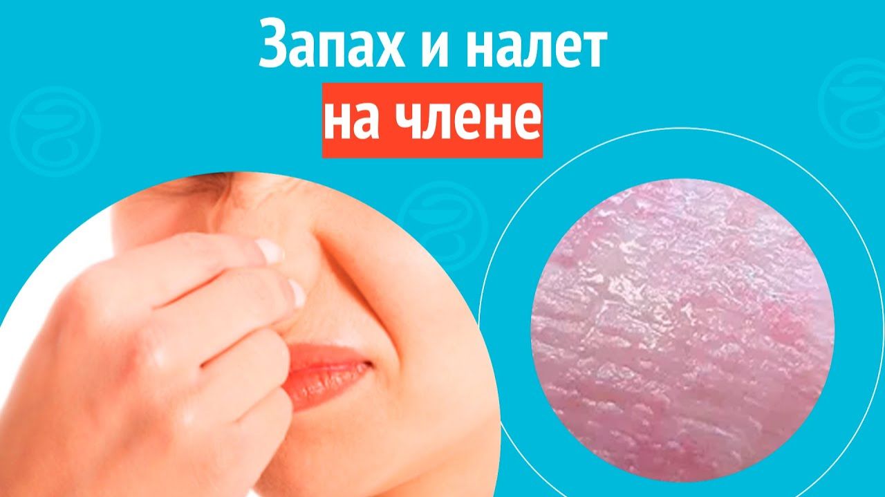 😧 Запах и налет на члене. Клинический случай №1582 смотреть онлайн