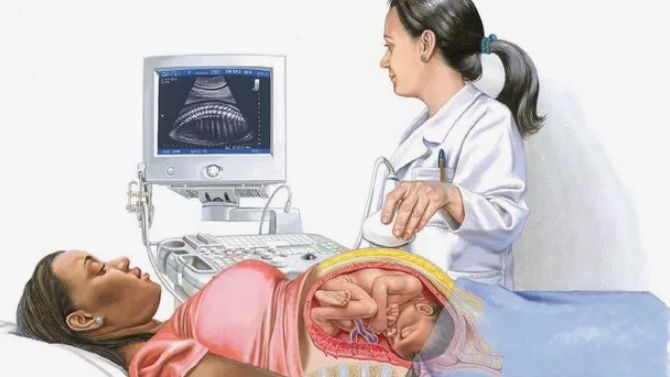 Биофизический профиль беременности смотреть онлайн