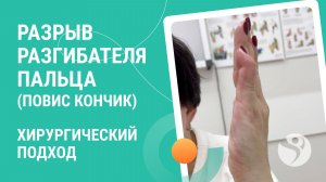 🧐 Разрыв разгибателя пальца (повис кончик). Хирургический подход