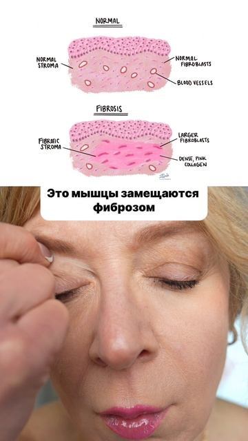 👆 ЛОВИ ссылку на НОВЫЙ ШИПКОВЫЙ МАССАЖ в прямом эфире по ссылке в комментариях смотреть онлайн