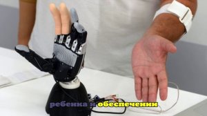 Потерявшему пальцы при взрыве СВУ в Красногорске мальчику установят протез