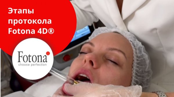 Этапы протокола Fotona 4D®