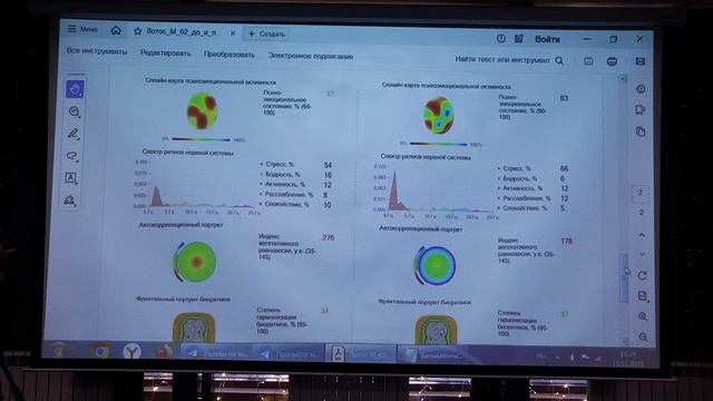 Эльмира Скиба о применении продуктов компании Full Energy смотреть онлайн