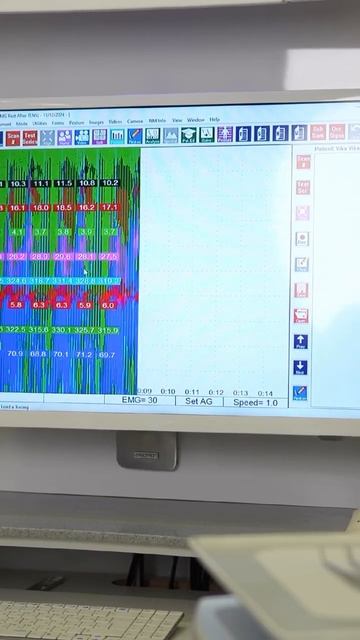ХРУСТИТ ЧЕЛЮСТЬ? Это не норма! смотреть онлайн