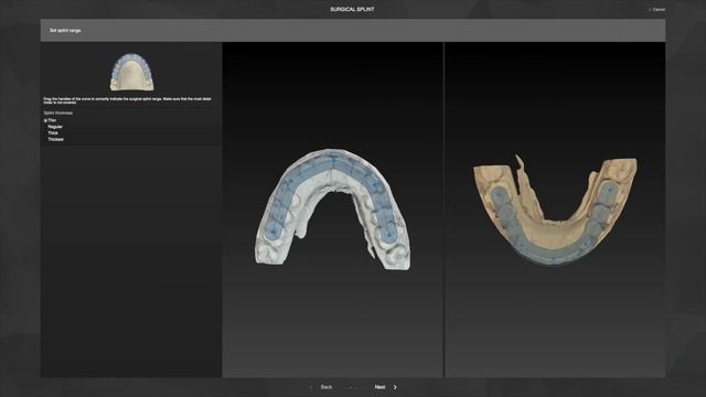 Рабочий процесс 7 - Создание хирургических шин _ IPS CaseDesigner® Руководство смотреть онлайн