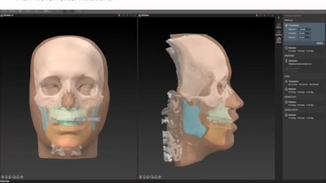 Рабочий процесс 6 - Планирование перемещения _ IPS CaseDesigner® Руководство смотреть онлайн