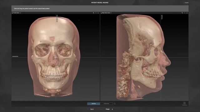 Рабочий процесс 1 – Загрузка модели пациента _ IPS CaseDesigner® Руководство смотреть онлайн