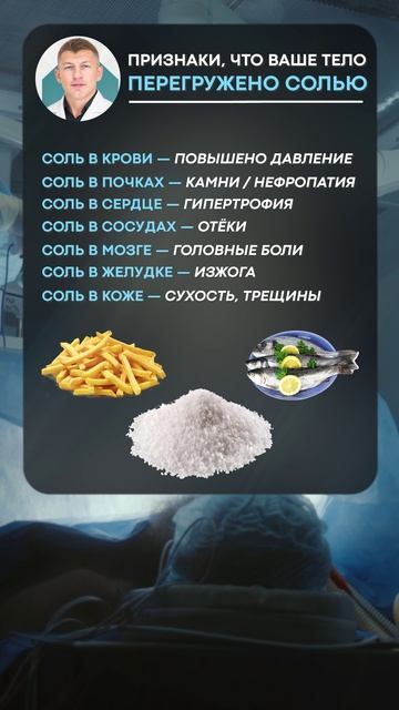 ОПАСНЫЕ признаки избытка СОЛИ! #здоровье #организм #соль смотреть онлайн