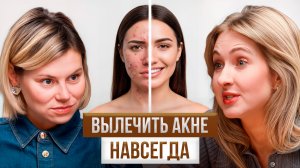 АКНЕ, ГОРМОНЫ и ДЕРМАТИТ - секреты чистой кожи в любом возрасте? Гинеколог и дерматолог -вся правда