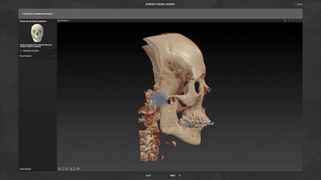 Рабочий процесс 2 – Создание хирургических моделей _ IPS CaseDesigner® Руководство смотреть онлайн