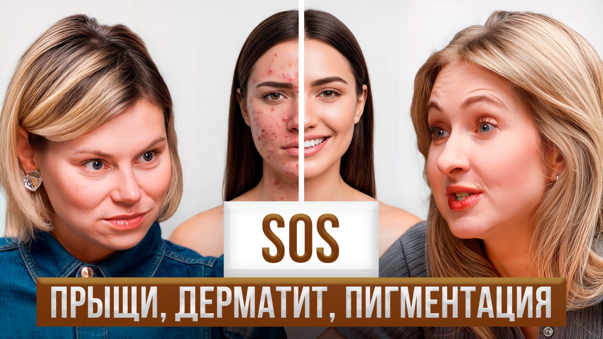 АКНЕ, ГОРМОНЫ и ДЕРМАТИТ - секреты чистой кожи в любом возрасте? Гинеколог и дерматолог - вся правда смотреть онлайн