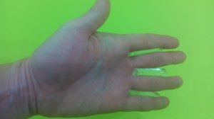 Кристаллы кварца между фалангами пальцев