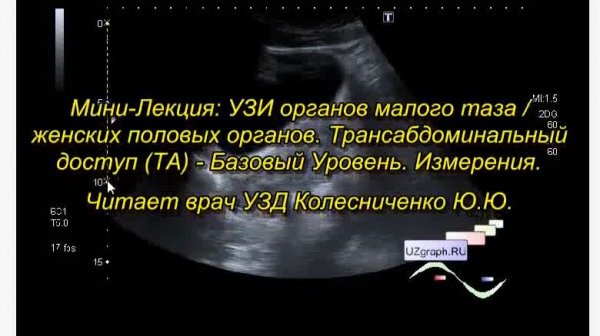 Лекция: УЗИ органов малого таза, Трансабдоминальный доступ (ТА) - Базовый Уровень