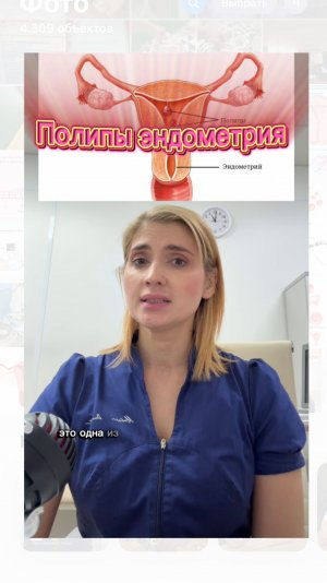 Полипы эндометрия