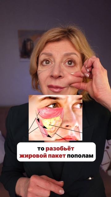 В 50+ мешки и грыжи ушли!😱 смотреть онлайн