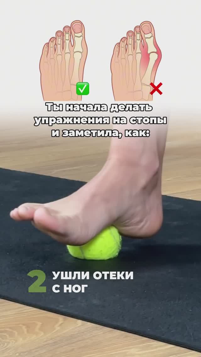 Самые эффективные упражнения для стоп, которые помогают от отеков и болей в колене. смотреть онлайн