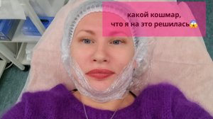 Косметолог: триада, канюля - страх😱//оркестр при свечах//Микротоки//Что связала//Что на спицах.