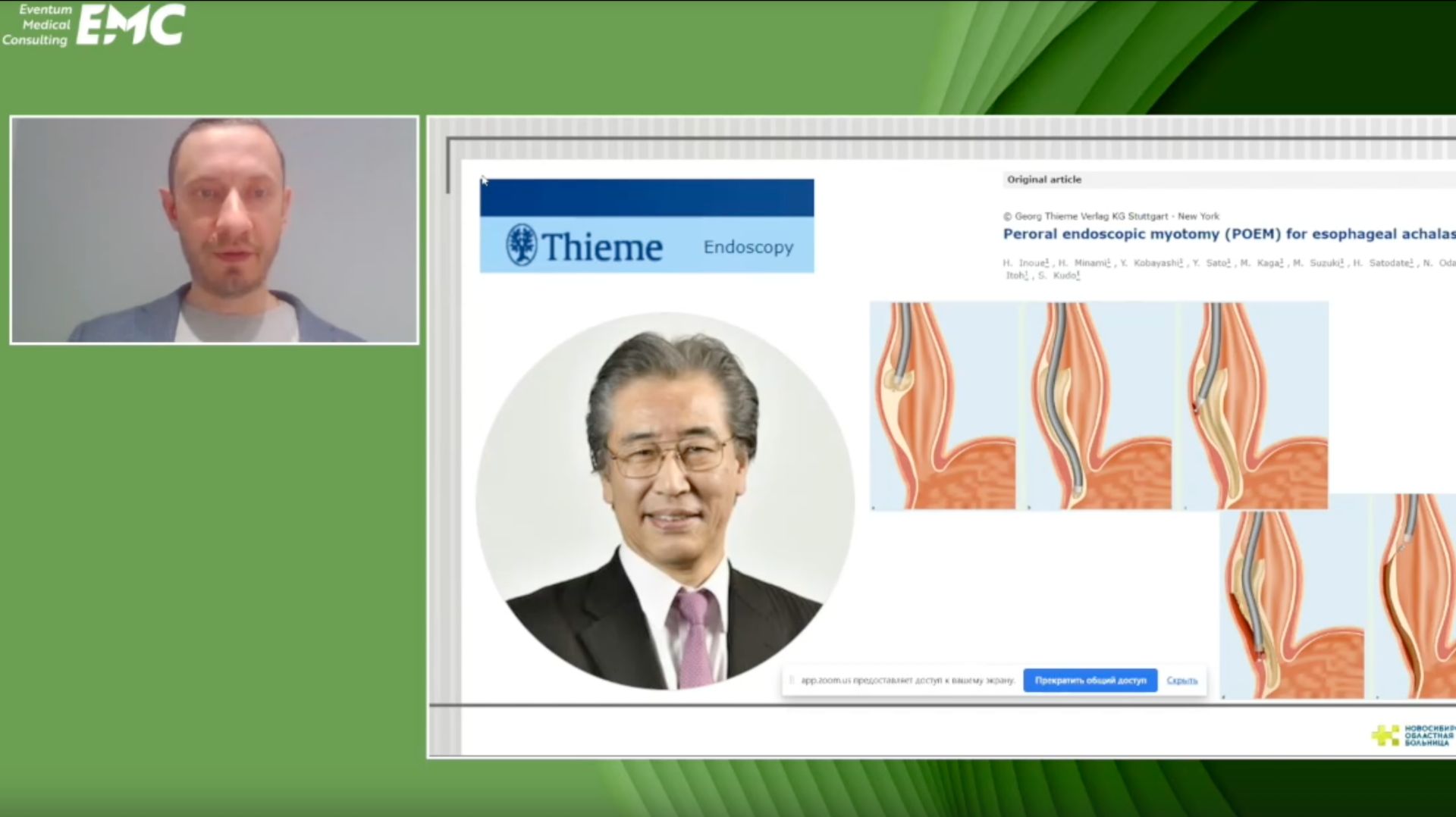 3. Дробязгин Е.А. Опыт ПОЭМ в лечении пациентов с ахалазией кардии.