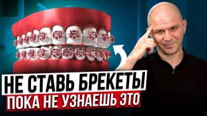 Отвечаю на все вопросы об установке брекетов и разрушаю все мифы о брекетах