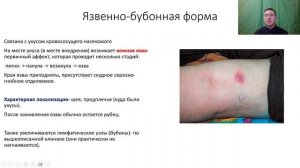 Туляремия. Лекция для студента и практикующего врача.