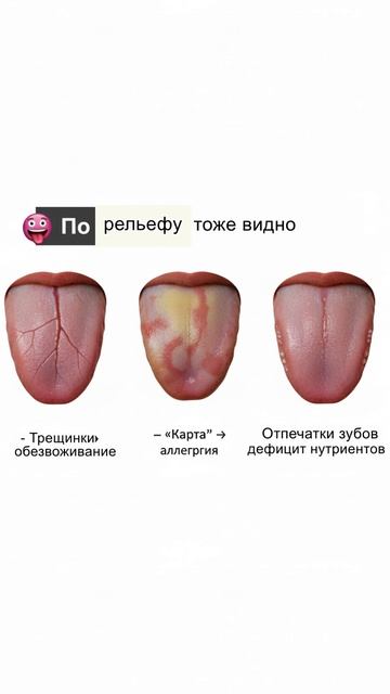 Посмотрите на язык — он расскажет, чего не хватает вашему организму! #shorts